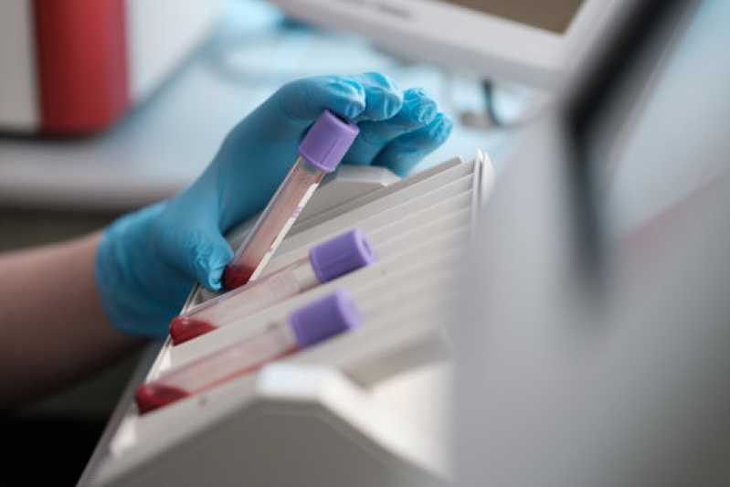 Clínica Especializada em Exame para Detectar Cinomose Lins - Exame de Sangue Cinomose