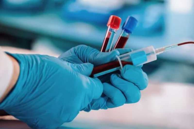 Contato de Laboratório de Diagnóstico Genética Equina Guarapuava - Laboratório de Diagnóstico Sanger
