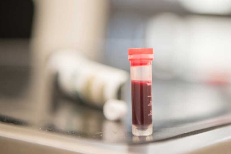 Contato de Laboratório de Diagnóstico Sanger Aperibé - Laboratório de Diagnóstico de Biologia Molecular