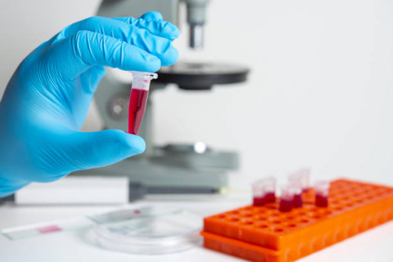 Onde Faz Teste de Micoplasma para Controle de Qualidade de Cultivo Barbacena - Teste de Micoplasma em Laboratório