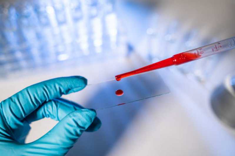 Onde Faz Teste de Micoplasma Sobrenadante Barro Vermelho - Teste de Sobrenadante