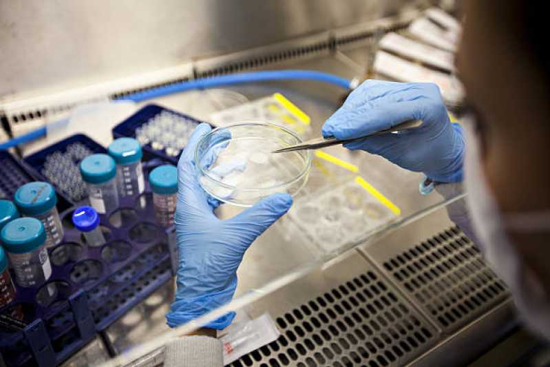 Onde Fazer Teste de Micoplasma para Contaminação Macaé - Teste de Micoplasma em Cultivo Celular