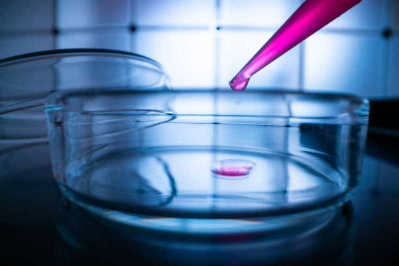 Onde Fazer Teste de Micoplasma para Controle de Qualidade de Cultivo Macaé - Teste de Micoplasma em Cultivo Celular