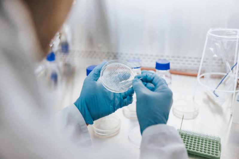 Onde Fazer Teste Micoplasma em Cultivo Celular Morada de Laranjeiras - Teste de Micoplasma Como Contaminante de Cultivo