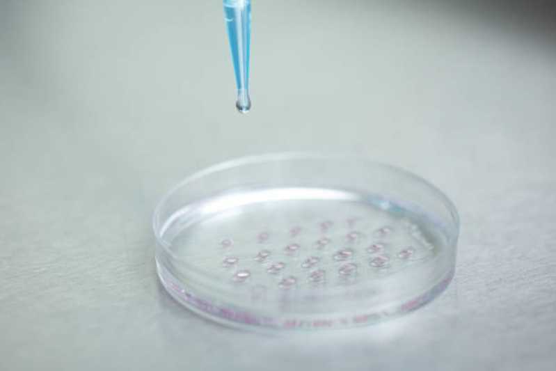 Teste de Micoplasma Cultivo Celular Empresa Niterói - Teste de Micoplasma Cultivo Celular