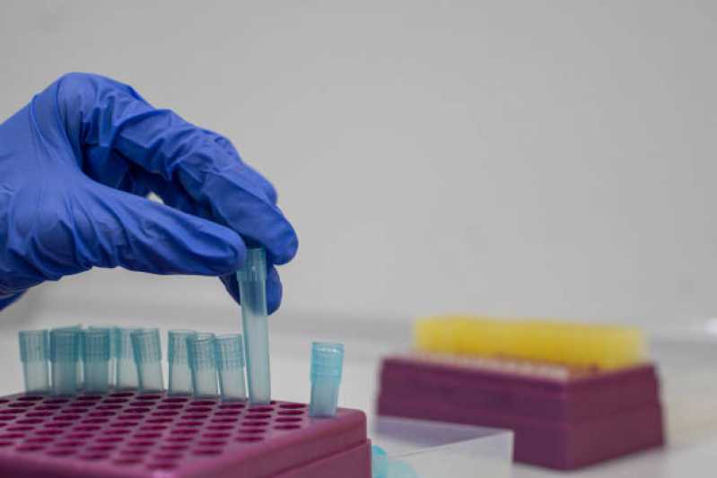 Teste de Micoplasma Sobrenadante Empresa Alegre - Teste de Micoplasma Cultivo Celular