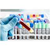 clínica especializada em exame de sangue fiv e felv Centro